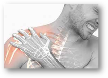 brachial plexus neuropathy icd 10
